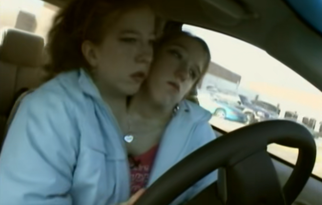 这就是罕见的双头人：一个身体长两颗头，并且能分别控制半边身体